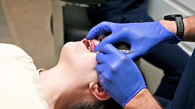 Orthodontist adjusting metal braces archwire on patient's teeth with dental instrument. Close-up showing brackets during orthodontic appointment.
