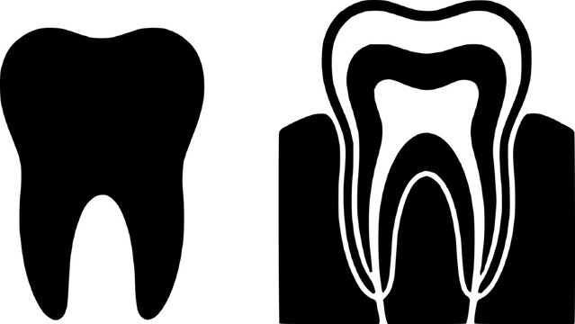 Dental anatomy illustration showing a solid black tooth and a detailed cross-section view with roots and nerves on white background for medical and educational purposes.