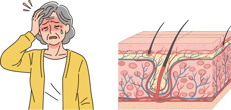 Senior Woman Suffering from Scalp or Hair Problems with Skin Layer Anatomy Cross Section Diagram for Dermatology and Aging Healthcare Vector Illustration