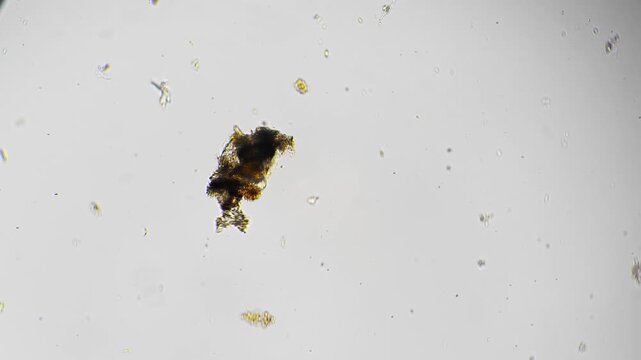 Microscopic detritus particle colonized by algae and microbes, irregular organic shape with attached microfauna, textured debris cluster on slide, useful for decomposition, nutrient cycling
