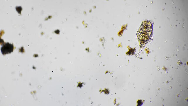 Microscopic rotifer feeding on suspended algae particles, active corona and mastax visible, fine debris and diatom fragments surrounding, laboratory slide brightfield imaging for science education