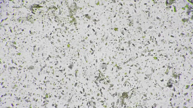 Dense algal microcommunity across field of view under microscope, scattered diatoms and chlorophyllrich fragments indicate bloom conditions sample analyzed by environmental monitor for nutrient study.