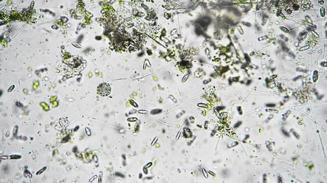 Detailed silica structures examination. Highresolution imaging of diatom skeletal remains. Advanced microscopy reveals intricate silica frustules and valve structures for taxonomic study