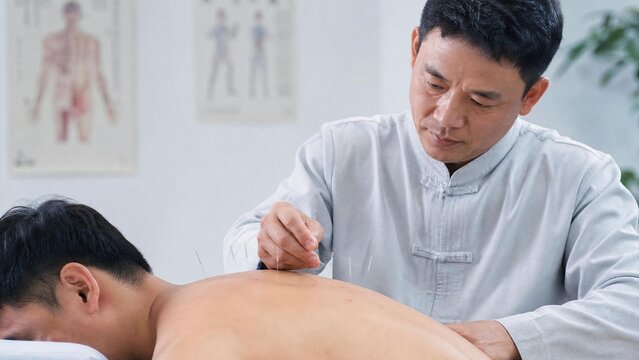 Traditional Chinese Medicine Practitioner Performing Acupuncture Treatment on Patient Back