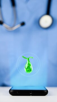 A doctor uses a mobile device with a 3D holographic gallbladder interface. Gallstone management and hepatobiliary health, medical AI technology, precision medicine, and remote monitoring.