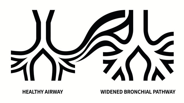 Comparison of healthy and widened bronchial pathways in a human respiratory system diagram.