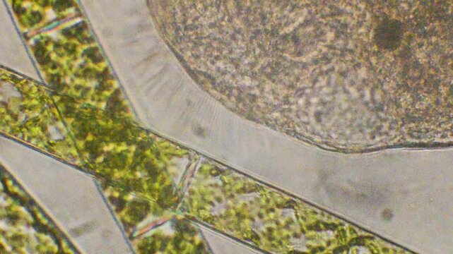 enlargement of protozoan cilia, ciliate and green algae, microscopy, microrganism, water, ciliata, algae, microscopic, Monza, Italy