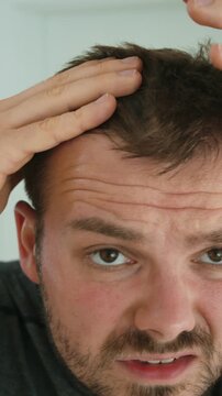 Close-up shot of a man checking his hairline and scalp with concern, showing hair loss, receding hairline, male grooming, aging, self-care, confidence, and personal appearance.