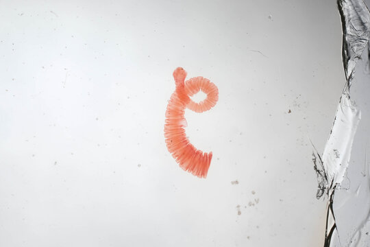 Taenia Solium Scolex And Strobila Stained Whole Mount