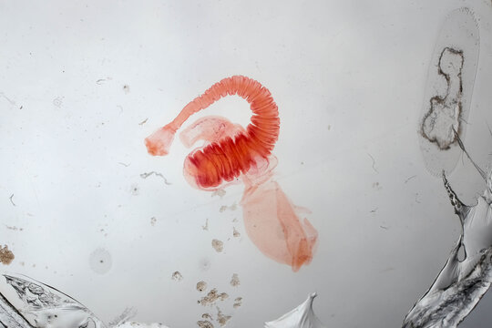 Taenia Solium Evaginated Cysticercus Scolex Rostellum Stained