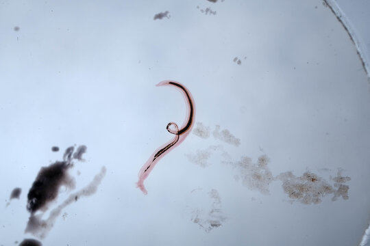 Schistosoma Japonicum Male Female Paired Worms Stained Whole Mount S