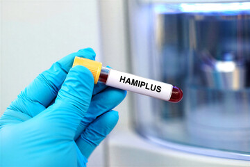 Fototapeta premium Closeup of a gloved hand holding a blood sample tube labeled for medical testing