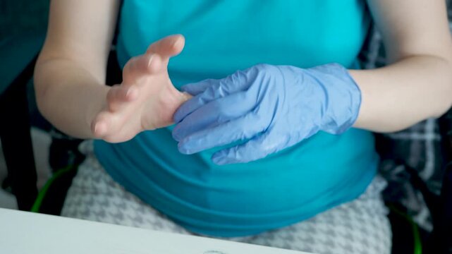 Woman applying soothing cream on painful thumb after computer work