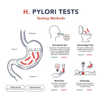 H Pylori Testing Methods Illustrated with Diagrams of Different Diagnostic Procedures