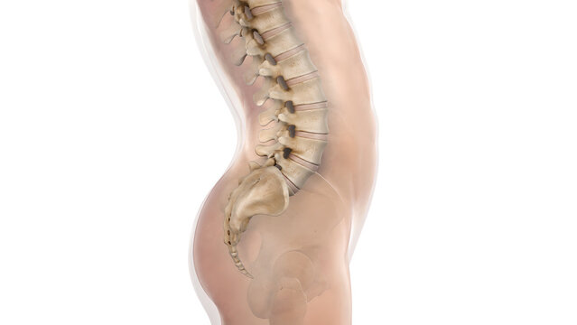 Lumbar Spine Lordosis Medical Illustration with Accentuated Lower Back Arch for Patient Education
