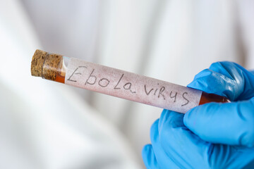 Obraz premium ebola virus test tube background white doctor coat surface close up of scientist hand holding blood sample medical product concept of infectious disease laboratory, outbreak control, virus analysis