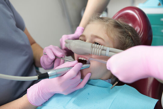 Little girl is comfortable to treat her teeth under superficial sedation. Little girl in dentist's office. Treatment of children's teeth with nitrous oxide. Milk teeth treatment.