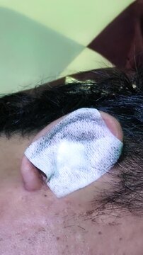 Close up of a man ear with white medical bandage plaster on it concept of ear injury wound healing after minor surgery skin infection treatment health care and first aid at home