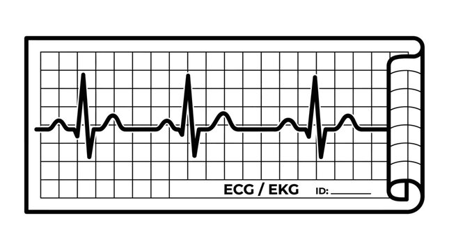 Electrocardiogram ECG Line Tracing on Medical Graph Paper Vector Illustration