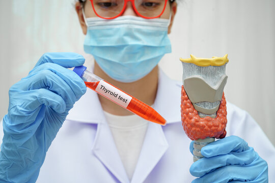 Doctor holding thyroid gland model and blood sample test tube in laboratory.