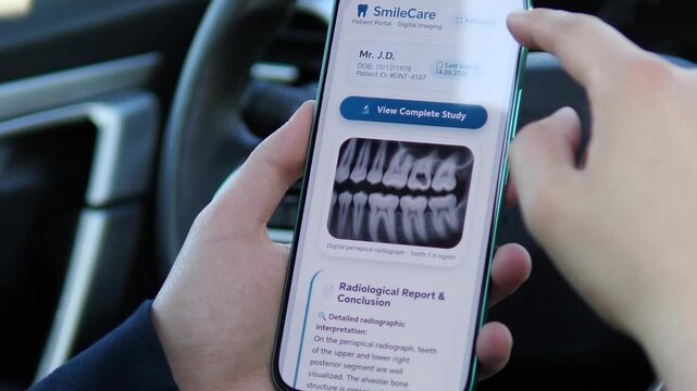 Viewing a patients dental imaging on the SmileCare app. The screen displays a periapical radiograph and a View Complete Study button. Perfect for telemedicine, digital dentistry, and patient portal