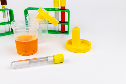 Full urine sample cup ready for vacuum transfer beside empty test tubes and green plastic holder racks on a white background