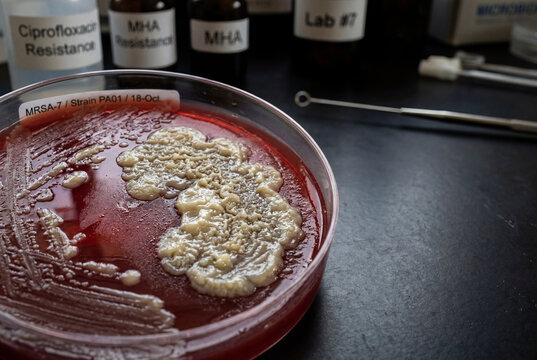 A petri dish contains bacterial culture growing on a red agar surface in a laboratory. Various bottles and tools are seen around the dish, indicating research on antibiotic resistance