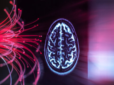Brain scan and fiber optics depicting AI versus human intelligence