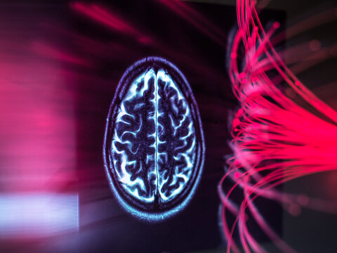 Brain scan and fiber optic showing artificial intelligence concept