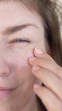 Woman touches and checks crow feet fine line wrinkles around eye area in anti-aging beauty concern closeup. Expression wrinkle footage for aesthetic clinic promotion, botox content, anti-wrinkle serum