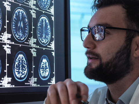 Doctor reading MRI brain scan on screen