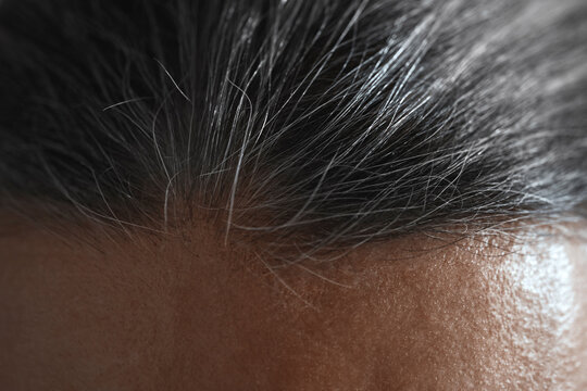 Close up of forehead and scalp showing gray hair and aging process