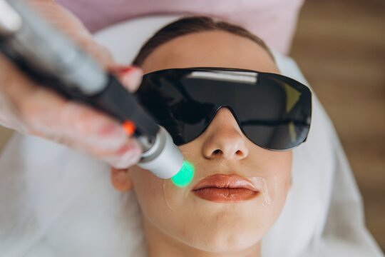 Patient receiving facial laser treatment in dermatology clinic