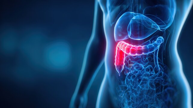 Detailed 3D medical illustration of inflamed human appendix with acute appendicitis, anatomical cross-section view showing swollen organ, inflammatory tissue and abdominal intestinal structure 