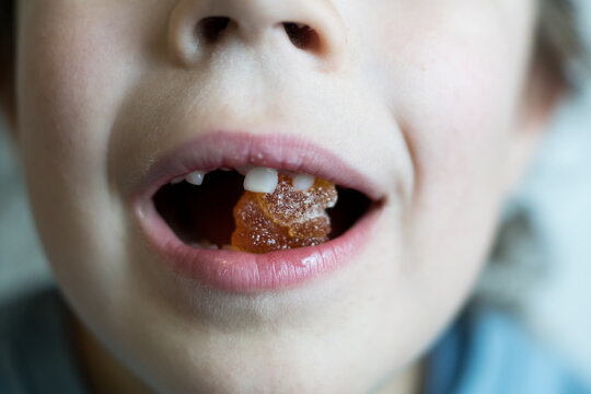 Frontal close-up of a child's mouth open with an orange gummy bear inside, clearly showing missing front teeth during the dental development stage.
