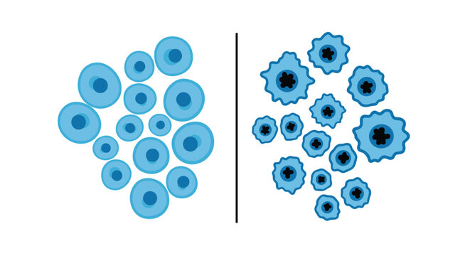 Scientific comparison between healthy circular cells and abnormal diseased cells with irregular shapes and dark nuclei in a diagram.