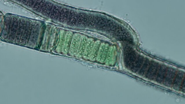Bangia sp. red algae cells at 50x brightfield, extended focus