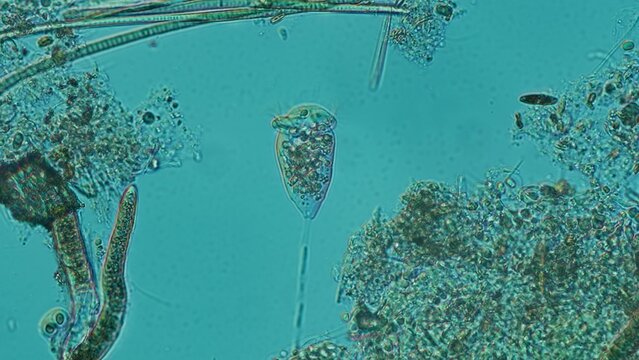 Vorticella sp. stalked ciliate at 20x under Nomarski DIC microscopy