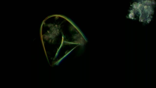 Testate amoeba sp. shell at 20x under darkfield microscopy