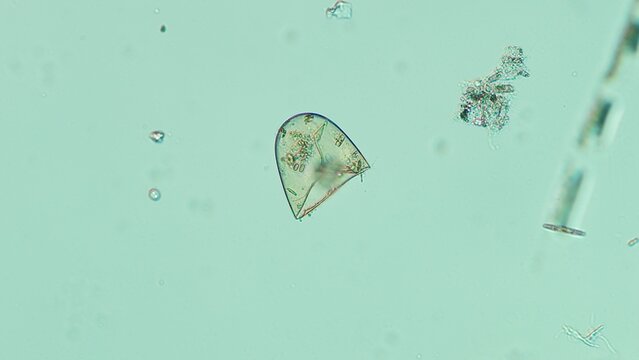 Testate amoeba sp. shell at 10x under Nomarski DIC microscopy