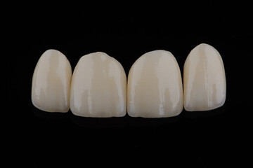 High-quality four dental crowns made of zirconium for fixation to the frontal teeth of upper jaw. © gorynvd