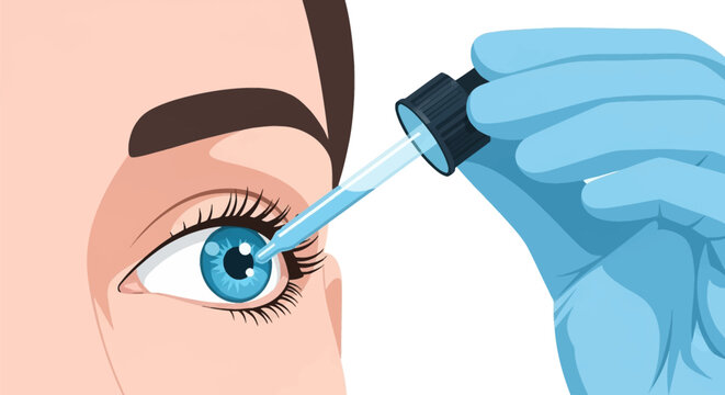 Vector illustration of a medical professional in a blue glove using a glass pipette to apply liquid eye drops into a human eye with a blue iris for ocular health treatment.