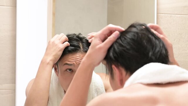 髪の生え際を気にする日本人男性