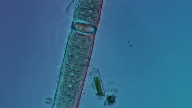 Cyanobacteria filament detail at 50x in Nomarski DIC microscopy