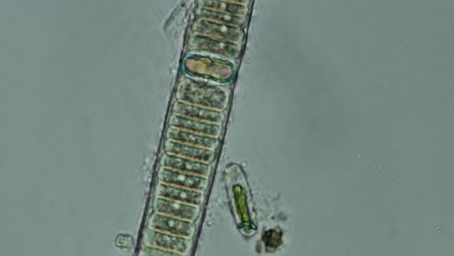Cyanobacteria filament at 50x in brightfield microscopy with extended depth of field
