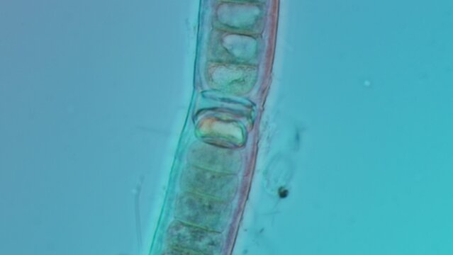 Cyanobacteria heterocyst close-up at 50x in Nomarski DIC microscopy