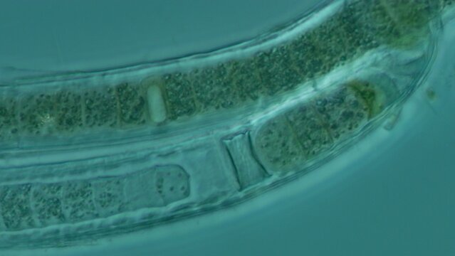 Cyanobacteria heterocyst at 50x in cross-polarized transmitted light microscopy