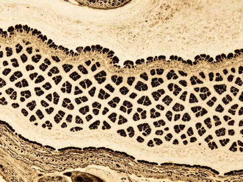 Original Von Kossa stain of human bone trabeculae, characteristic black calcium phosphate deposits, normal bone tissue, natural histochemical contrast, authentic pathology specimen