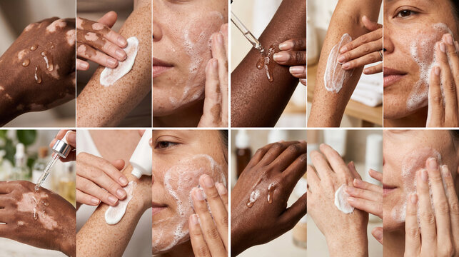 diversity type skin vitiligo with serum drops on hand, white cream on arm and facial foam cleanse Morning skincare routine professional care cosmetology products