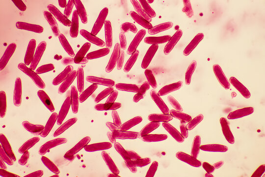 Rod Shaped Bacteria Pink Red Stain Microscope Closeup Showing Bacillus Cell Colony Microbiology Medical Science Concept
